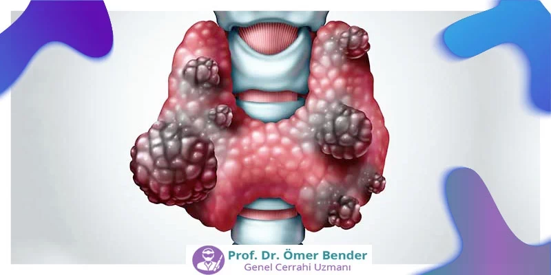 Tiroid Kanseri Tanısı Nasıldır?
