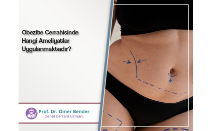 obezite-cerrahisinde-hangi-ameliyatlar-uygulanmaktadir-prof-dr-omer-bender