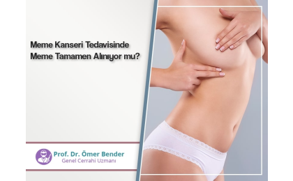 meme-kanseri-tedavisinde-meme-tamamen-aliniyor-mu-prof-dr-omer-bender