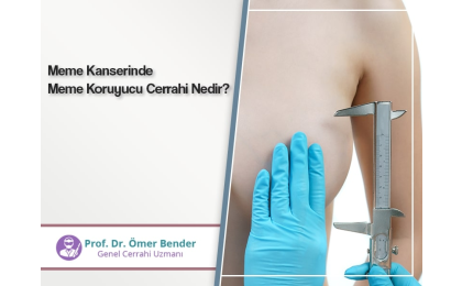 meme-kanserinde-meme-koruyucu-cerrahi-nedir-prof-dr-omer-bender