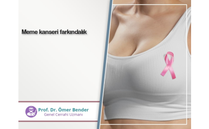 meme-kanseri-farkindalik-prof-omer-bender