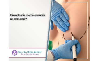 onkoplastik-meme-cerrahisi-ne-demektir-prof-dr-omer-bender