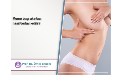 meme-basi-akintisi-nasil-tedavi-edilir-prof-dr-omer-bender