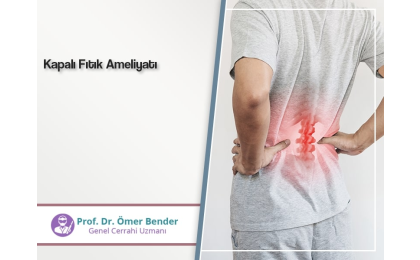 kapalı fıtık,kapalı fıtık ameliyatı,ömer bender