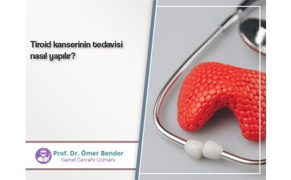 tiroid kanseri tedavisi