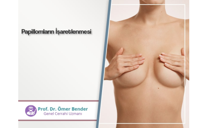 papillomlarin-isaretlenmesi-prof-dr-omer-bender
