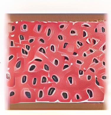 duktal-karsinoma-in-situ-dcis