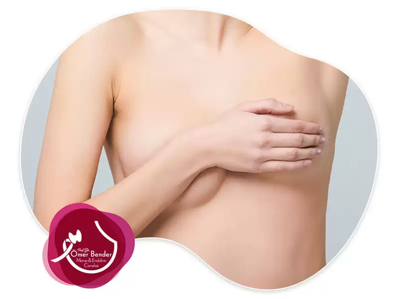 Kadınlarda Meme Başı Akıntısı