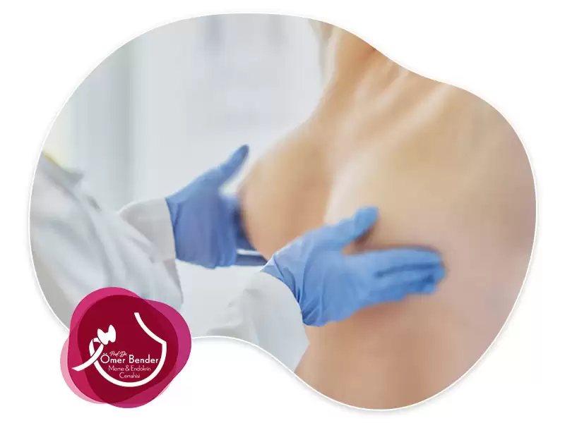 Meme Başından Sıvı Gelmesinin Tedavi Yöntemleri Nelerdir?