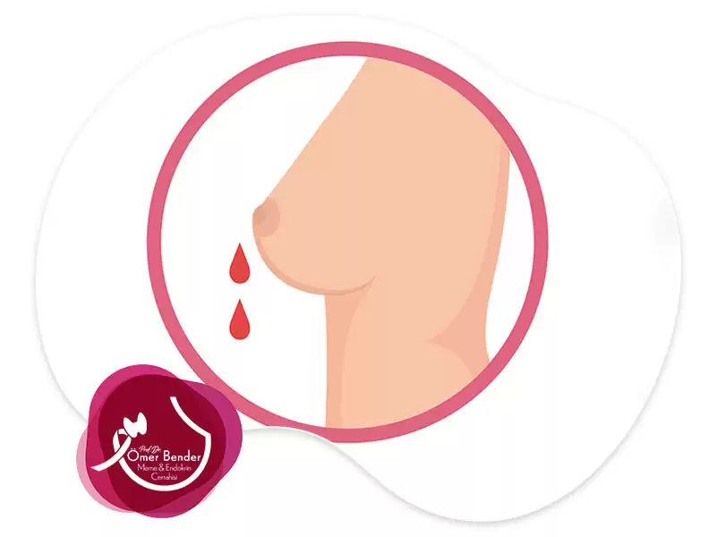 Meme Ucundan Kan Gelmesi