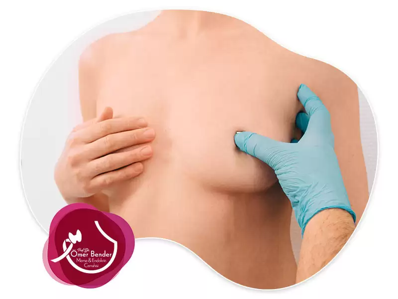 Memede Akıntı ve Ağrı Tedavisi