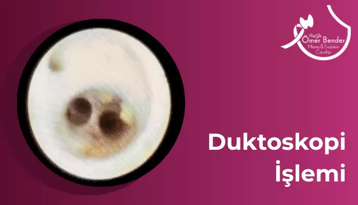 Duktoskopi İşlemi